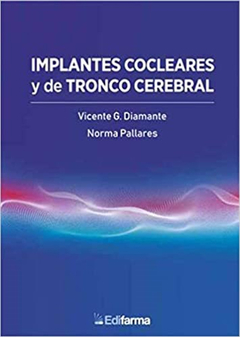 Implantes cocleares y de tronco cerebral