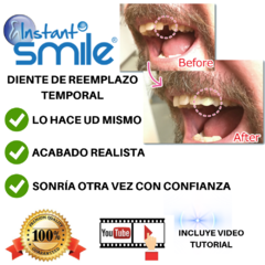 Dentadura Cosmética Postiza Termomoldeables Agnovedades