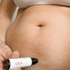 Cicaroll: aceite hidratante para la zona de la cicatriz post-cesárea