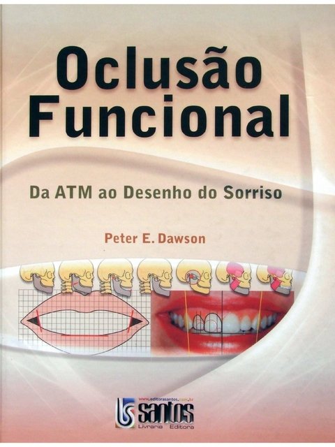 Impacto - Cor e Forma Interna de Dentes Anteriores (Edição