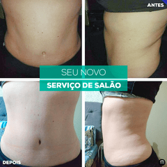 Imagem do Slim Body + cinta térmica - Tratamento para 30 dias.