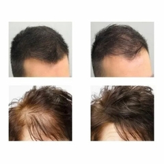 Instant Hair Plus Castanho Médio 300ml - comprar online