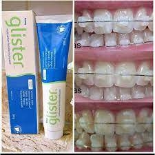 gel dental glister amway 200g