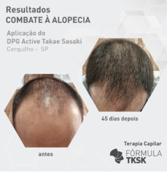 KIT Antiqueda - Takae Sasaki - Terapia Capilar