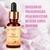 Red Chestnut Floral de Bach | PharmaClinic Manipulação Personalizada