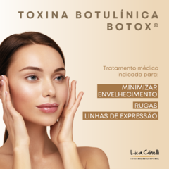 TOXINA BOTULÍNICA (BOTOX ®)