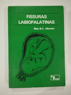 Fissuras Labiopalatinas - Elisa B C Altmann