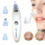Máquina Sucção e Removedor de Cravos Espinhas Acne – DermaSuction na internet