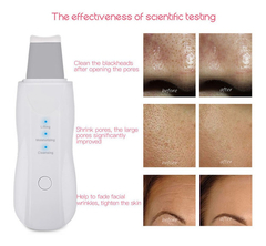 Espátula Facial Ultrasónica Peeling Skin Scrubber Recargable en internet