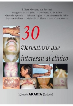 30 Dermatosis que interesan al clinico - Fossati