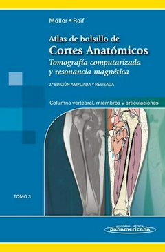 Atlas de Bolsillo de Cortes Anatómicos: Tomo 3 - Ed. 2 Tomografía computarizada y resonancia magnética: Columna vertebral, Miembros y Articulaciones - Moller
