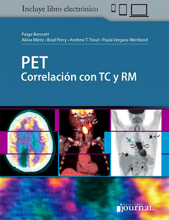 PET Correlación con TC y RM - Bennett / Mintz