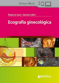 Ecografía ginecológica - Roberto Gori / Daniel Cafici