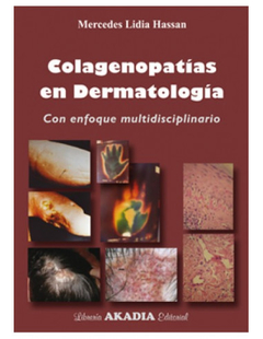 Colagenopatias en Dermatologia - Hassan