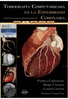 Tomografia computarizada en la enfermadad coronaria - Carrascosa