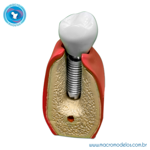 Modelo Hemi Mandibula de Jovem - Outros Livros - Magazine Luiza