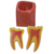 Macro Modelo Molar - Macro Modelos Odontológicos