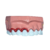 Macro Modelo Evolução da Doença Periodontal - Macro Modelos Odontológicos
