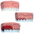 modelo da doença periodontal