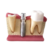 Macro Modelo contendo Ponte Fixa com 3 Elementos e 1 Macro Implante com Núcleo - Macro Modelos Odontológicos