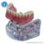 Macro Modelo Overdenture Mandíbula Acrílica Barra Clip + Prótese na internet