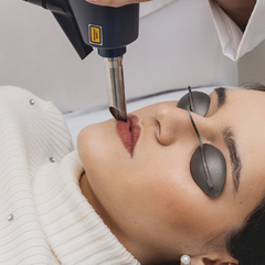 Laser de Rejuvenescimento Facial, Pescoço e Colo - comprar online