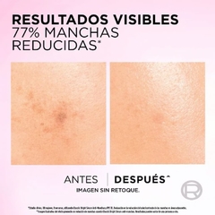 Anti-Manchas Glycolic Bright L'Oréal Paris resultados sobre manchas