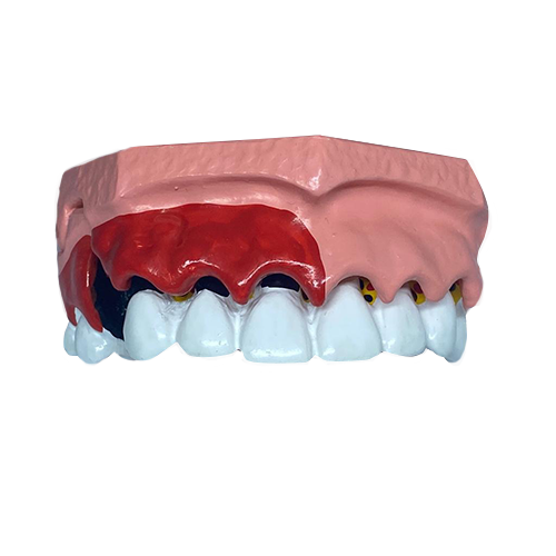 A-PB: Modelo Maxilar e Mandibular para Periodontia FRASACO - Dentaltix