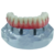 Modelo Mandibula com protocolo Branemark de 4 implantes