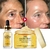 Conjunto de Sérum Facial Ouro 24K Ácido hialurônico Sérum para Acne Hidratante na internet