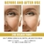 Conjunto de Sérum Facial Ouro 24K Ácido hialurônico Sérum para Acne Hidratante