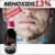 Kit Crecimiento de Barba con Minoxidil al 13% Max en internet