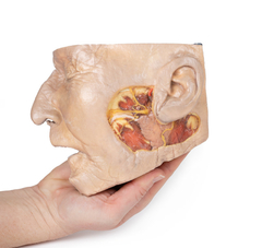 Modelo 3D de Glândula parótida e dissecção do nervo facial na internet