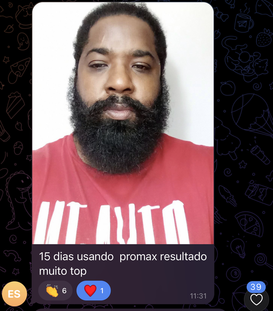 Preenchimento de falhas na barba