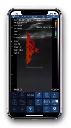 Imagen de Escáner Importado de ultrasonido Digital inalámbrico, máquina de ultrasonido portátil, sonda Viatom 3 en 1