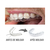 3 Bisnagas Clareador Dental Whiteness Simple 16% + Moldeiras - Clareador Dental