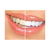 Clareador Dental Whiteness Perfect 22% - FGM - 5 Un + 1 Par de Moldeiras - Clareador Dental