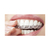 6 Unidades Clareador Dental Caseiro Whiteness Simple 16% na internet