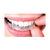 3 Seringas Whiteness Perfect Simple 22% Clareador Dental Fgm - comprar online