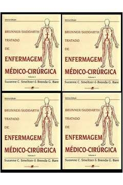 Brunner e Suddarth - Tratado de Enfermagem Médico-cirúrgica: 4 Volumes