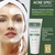 Mascara Acne Spec Secativa Cosmobeauty 150g - comprar online