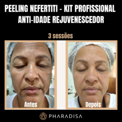 Peeling Nefertiti - Kit Profissional Anti-idade - Rejuvenescedor - comprar online