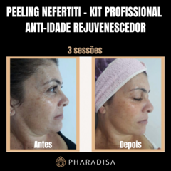 Peeling Nefertiti - Kit Profissional Anti-idade - Rejuvenescedor na internet