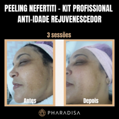 Peeling Nefertiti - Kit Profissional Anti-idade - Rejuvenescedor - Pharadisa Dermocosméticos I Preços e Descontos de Fábrica para Profissionais da Estética 