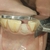 Pratos para Tratamento Endodôntico de Incisivos (Dente de Aço) - Ortovet | Qualidade Máxima para o Médico Veterinário