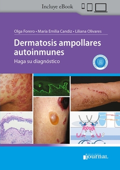 DERMATOSIS AMPOLLARES AUTOINMUNES