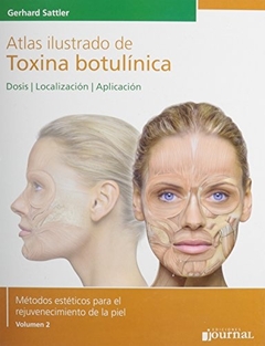 ATLAS ILUSTRADO DE TOXINA BOTULINICA