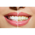 3 Seringas de Clareamento Dental Whiteness Simple 22% - FGM na internet