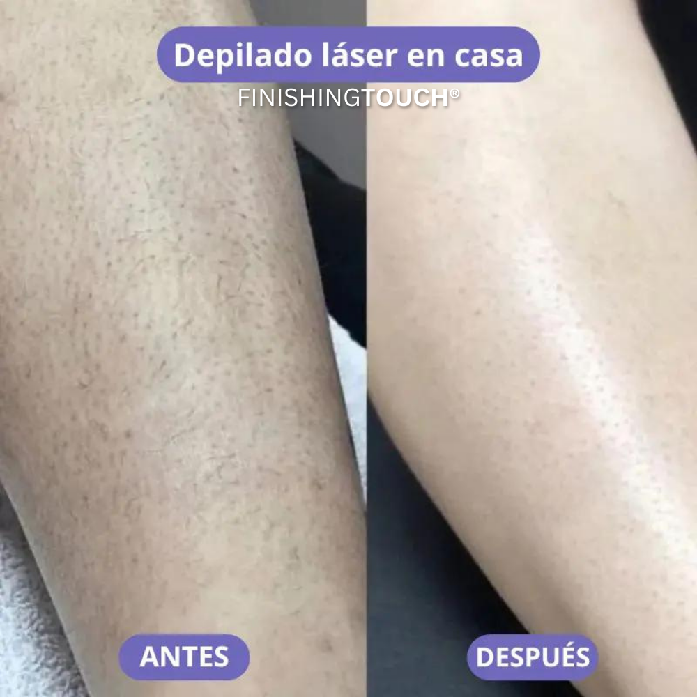 FINISHING TOUCH Depilacion laser rapida e indolora