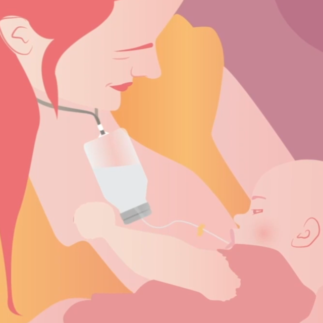 Relactador Estimulación Lactancia Materna Alimentación Bebé